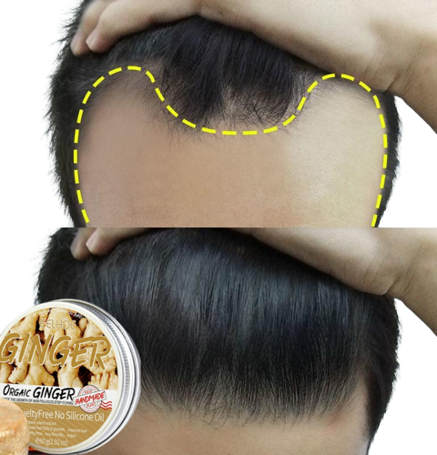 Ginger Hair Regrowth Shampoo Bar