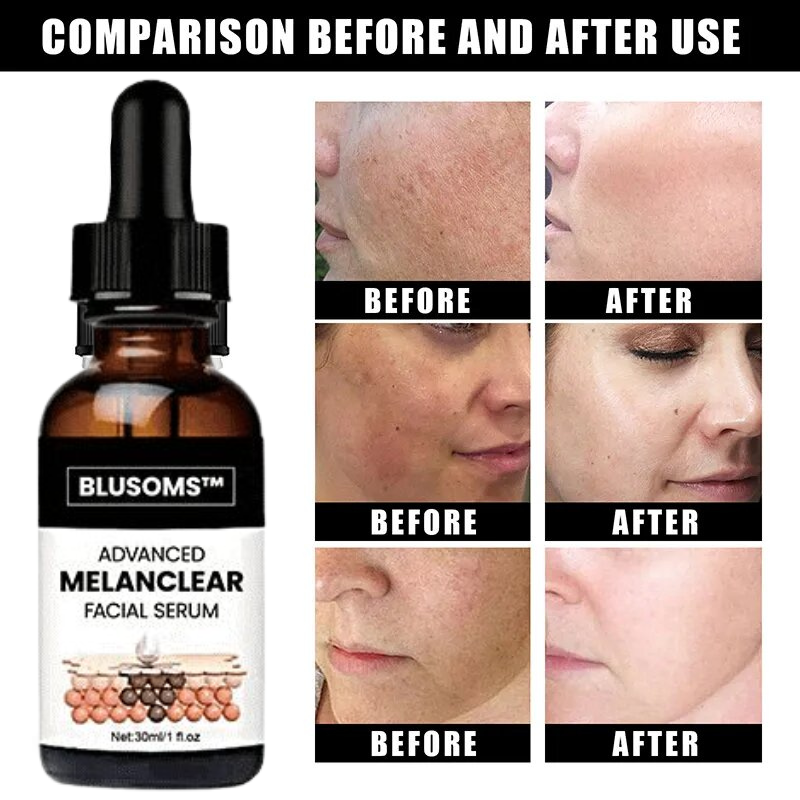 Blusoms™ Advanced MelanClear Facial Serum