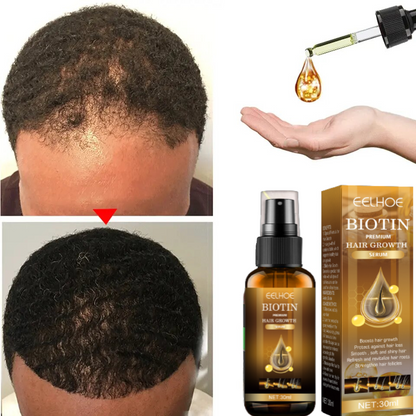 Biotin Hair Growth Spray