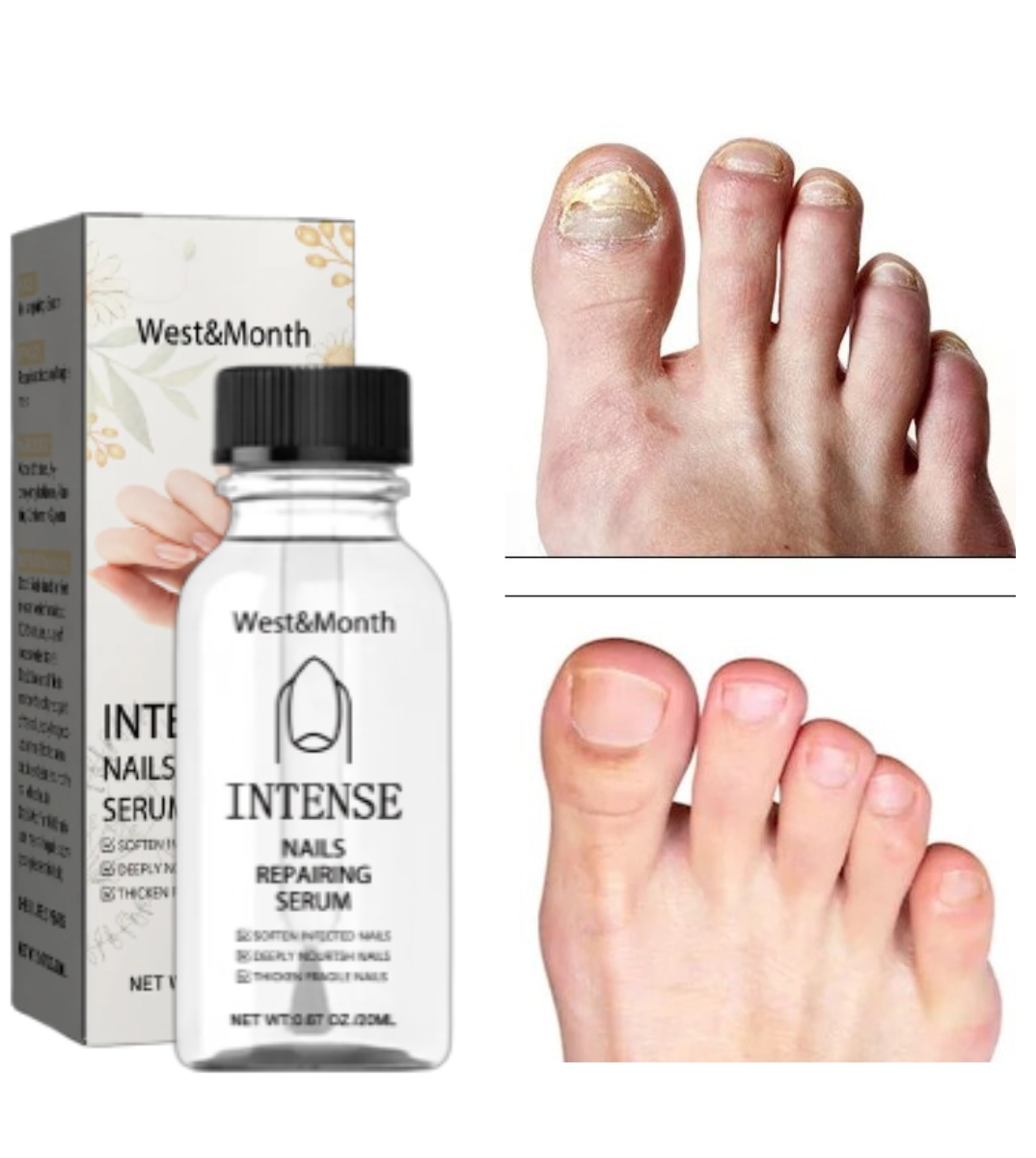 NailGro™ Intense Nail Growth and Strengthening Serum