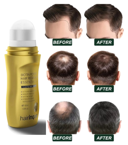 Unpree Biotin Regrowth Roll-On Hair Treatment