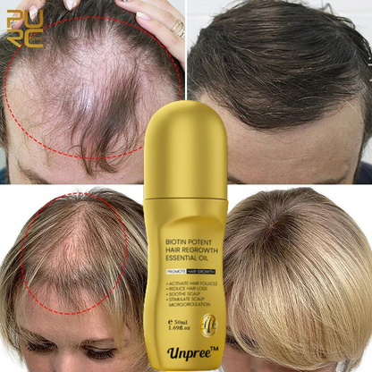 Unpree Biotin Regrowth Roll-On Hair Treatment