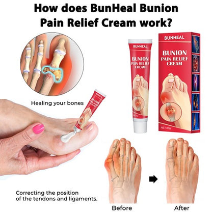 Bunion Pain Relief Cream – Soothing Herbal Comfort for Achy Feet