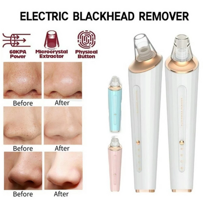 Blackhead Remover Pore Vacuum – USB Facial Pore Cleaning & Suction Device