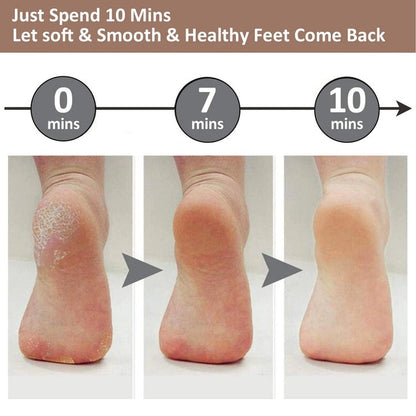 Rechargeable Electric Callus Remover