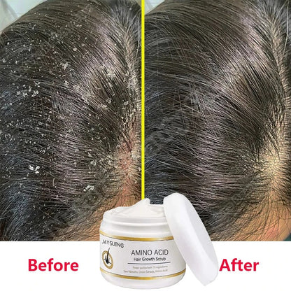 Biancat™ PrestigeStrand Hair Regrowth Scrub