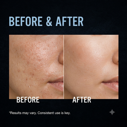 Exfoliating Facial Serum – Gentle Skin Smoothing & Brightening Essence (30ml)