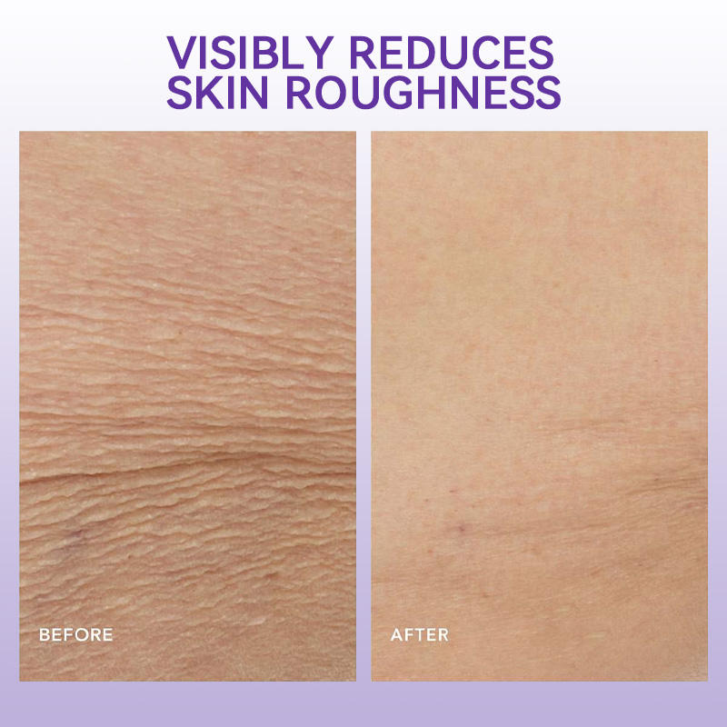 Skin Barrier Body Cream – Firming & Long-Lasting Moisturizing Care