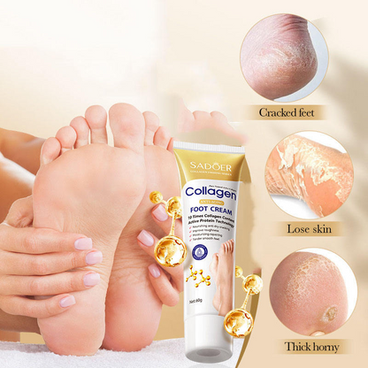 Collagen Foot Care Cream – Moisturizing & Repair for Dry Feet