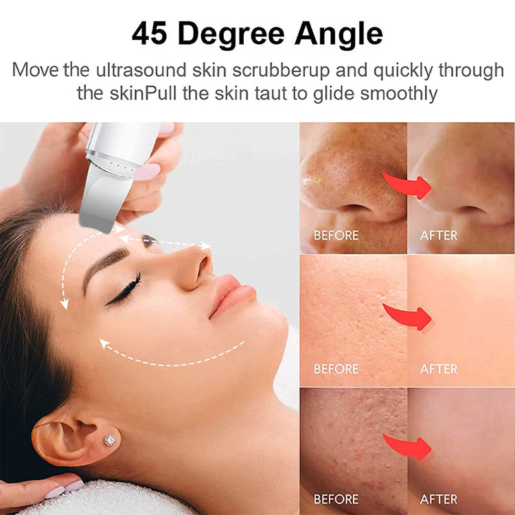 Ultrasonic Skin Scrubber – Facial Deep Cleansing & Blackhead Remover with Stainless Steel Head