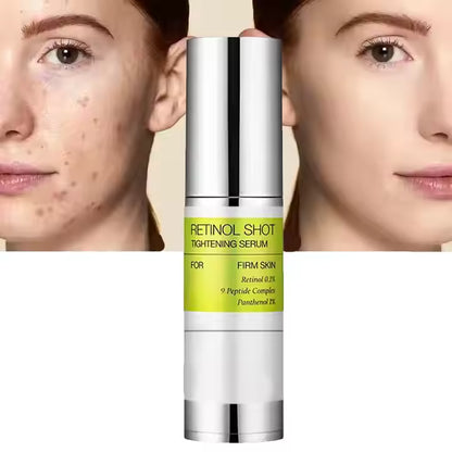 Retinol Tightening Serum – Firm, Smooth & Minimise Pores