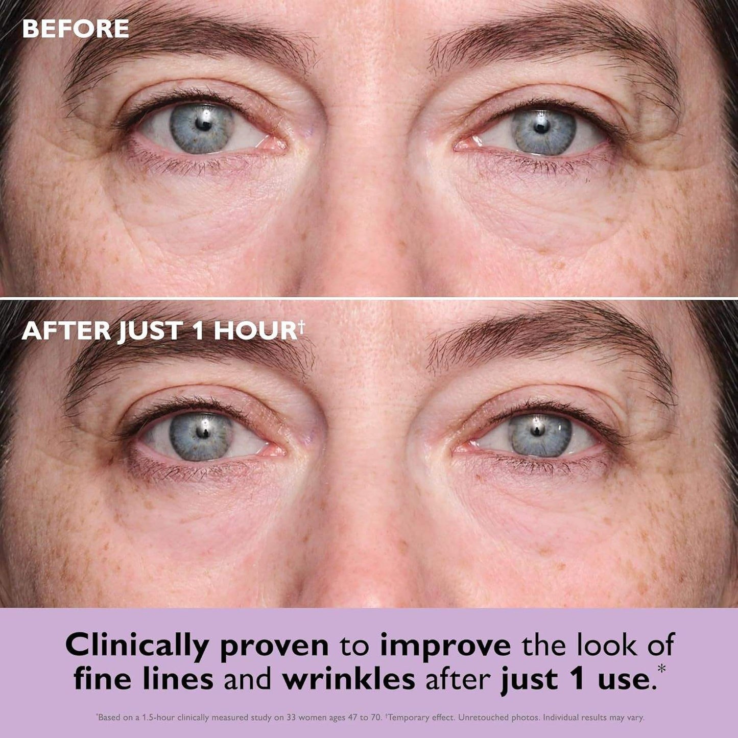 Instant Collagen Eye Patches – Lift, Brighten & Hydrate in Minutes