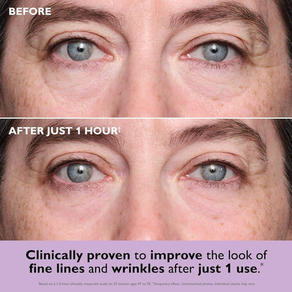 Instant Collagen Eye Patches – Lift, Brighten & Hydrate in Minutes