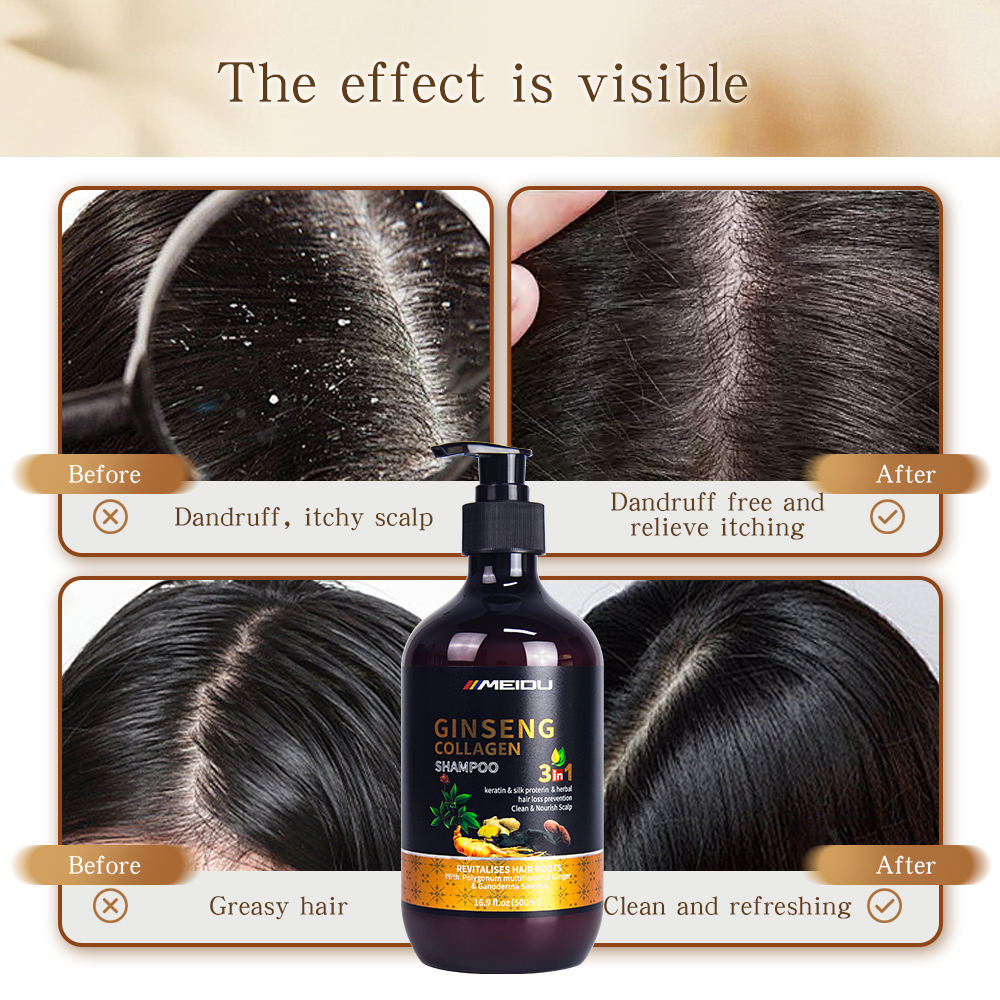 Salon Quality Anti–Hair Loss Shampoo – Nourishing Repair & Scalp Care