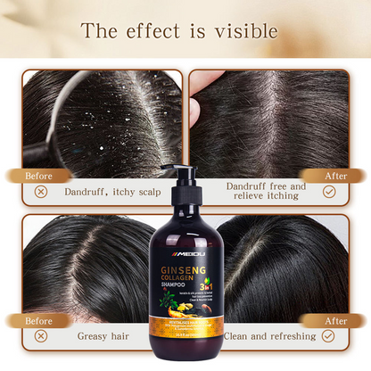 Salon Quality Anti–Hair Loss Shampoo – Nourishing Repair & Scalp Care