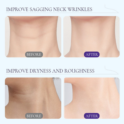 Niacinamide Peptide Neck Cream – Lift, Firm & Smooth Lines