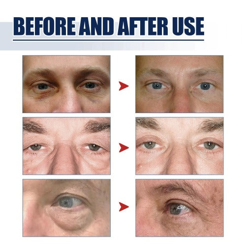 East Moon Peptide Lifting Eye Gel – Rejuvenating Eye Care Solution