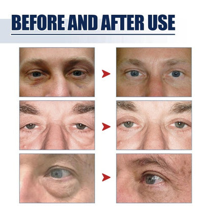 East Moon Peptide Lifting Eye Gel – Rejuvenating Eye Care Solution