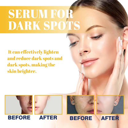 Brightening Night Repair Serum – Dark Spot & Even Skin Tone Care