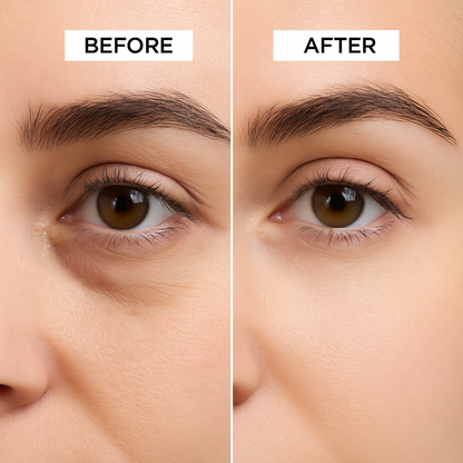 Vegan Retinol Eye Cream – Eye Repair Cream for Smooth & Refreshed Eyes