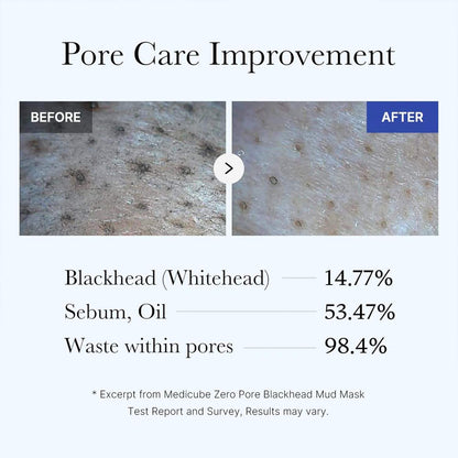 Medicube Zero Pore Blackhead Mud Mask – Deep Cleanse & Pore Care 100g