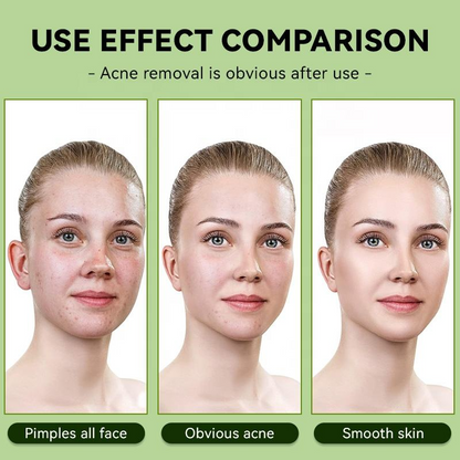 Centella Asiatica Facial Toner – Oil Control Hydrating Toner (200ml)