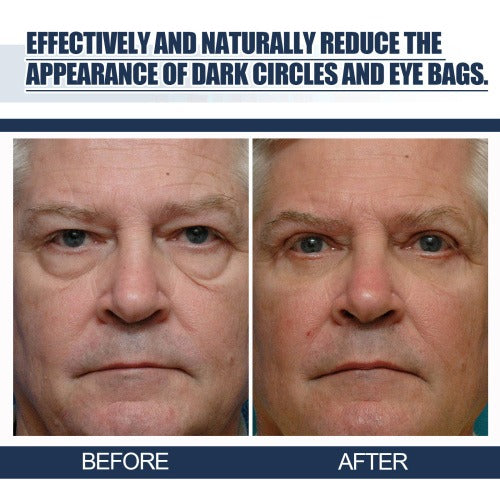 East Moon Peptide Lifting Eye Gel – Rejuvenating Eye Care Solution