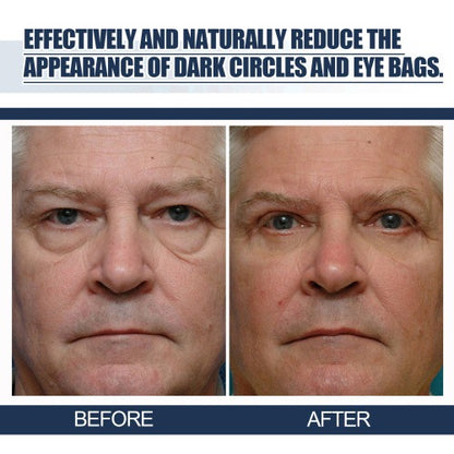 East Moon Peptide Lifting Eye Gel – Rejuvenating Eye Care Solution