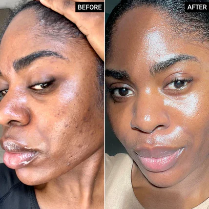 Moisturizing Face Cream – Natural Repair & Brightening Skin Care