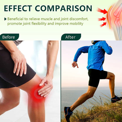 Leg Care Cream – Soothes Swelling, Inflammation & Discomfort