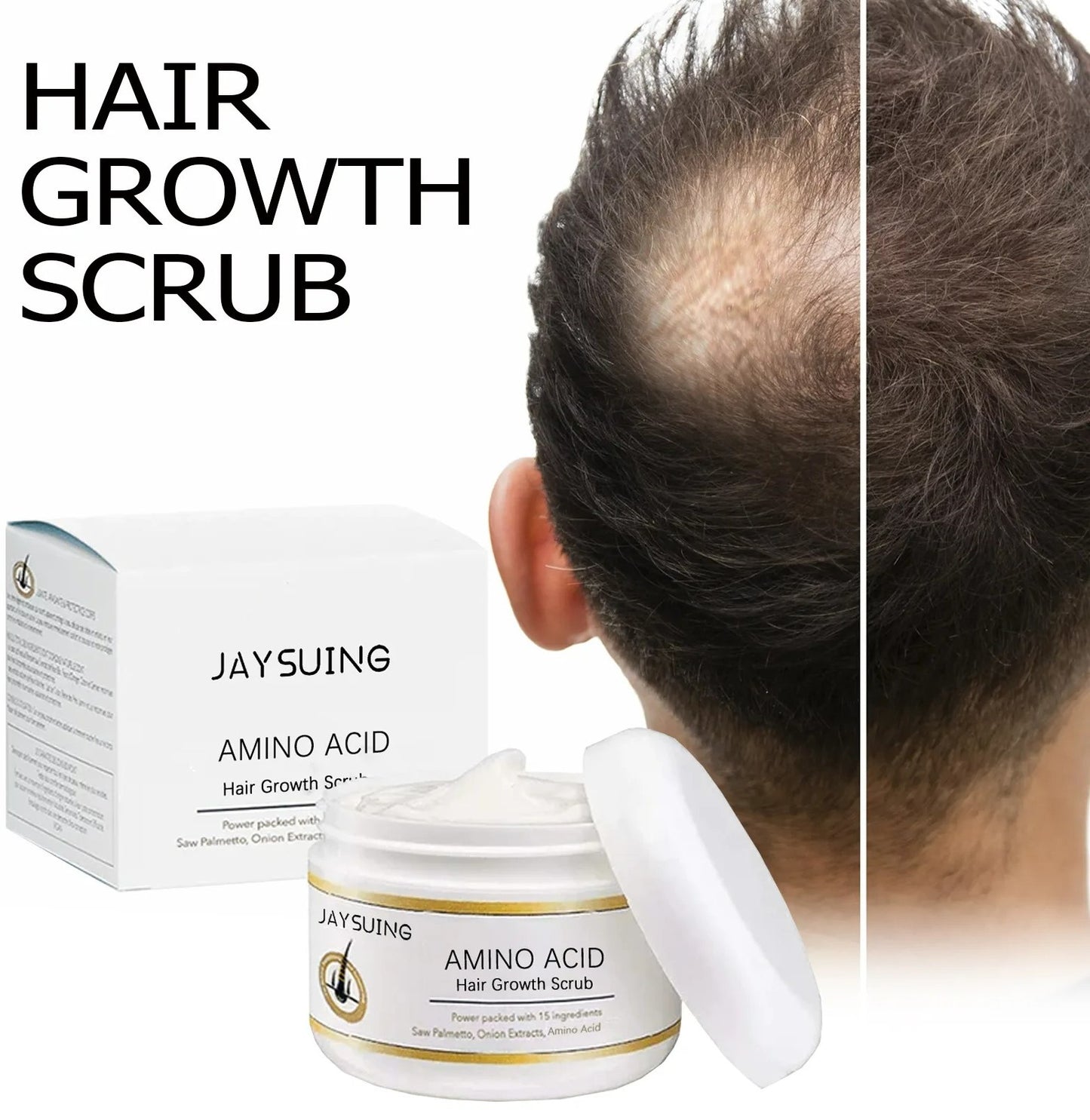 Biancat™ PrestigeStrand Hair Regrowth Scrub