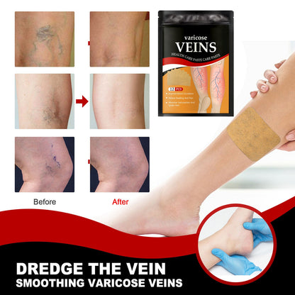 VeinPatch – Natural Relief for Varicose Veins & Tired Legs