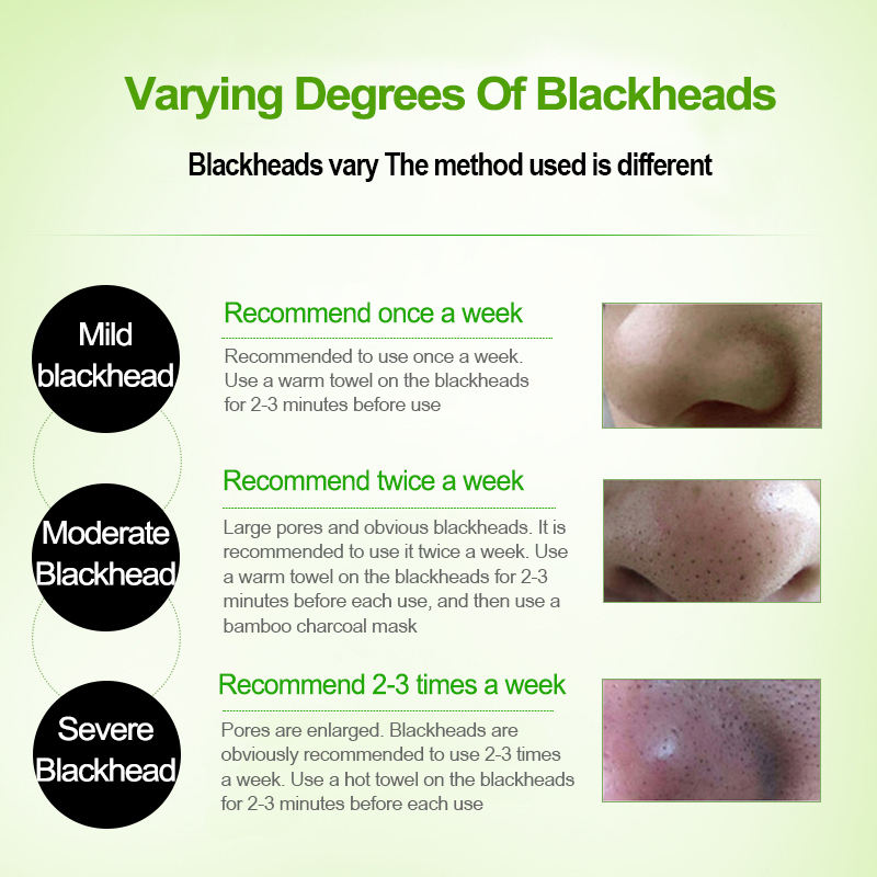 Peel Off Blackhead Remover Mask – Deep Clean & Smooth Pore Care