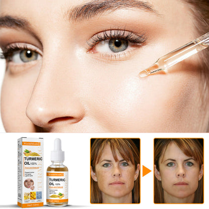 Turmeric Dark Spot Corrector Serum