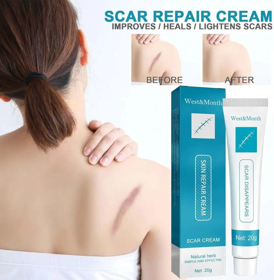 Acne Marks, Scars & Bumps Removal Creams