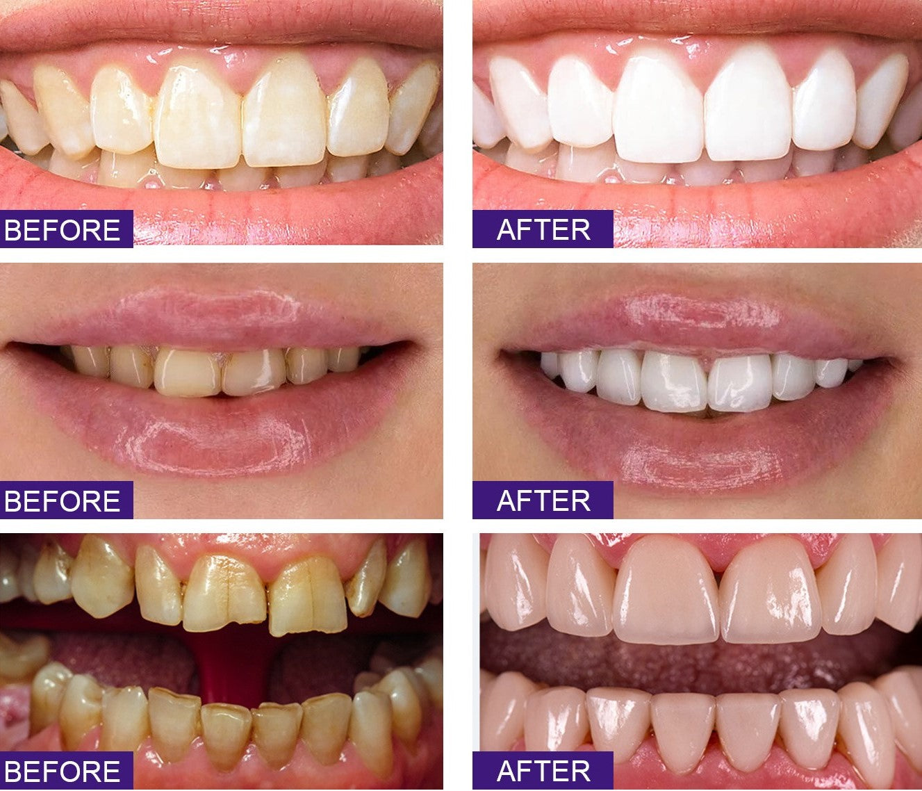 All Smiles-Brightening & Stain Removing Probiotic Toothpaste