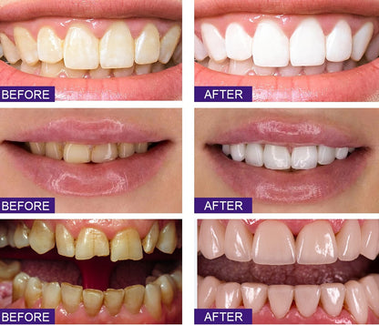 All Smiles-Brightening & Stain Removing Probiotic Toothpaste