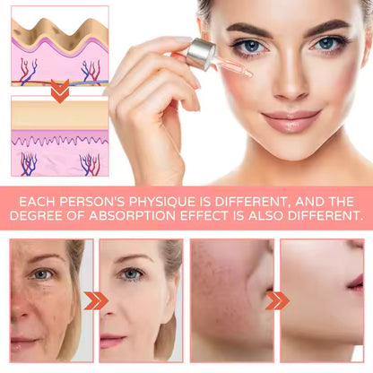 Botox Solution – Smooth, Firm, and Rejuvenate Without Injections