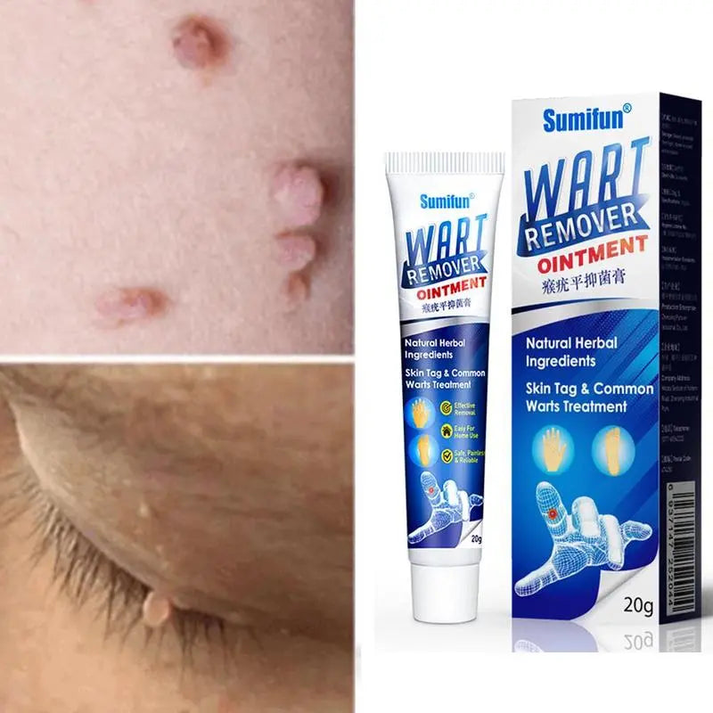 Wart Instant Blemish Cream
