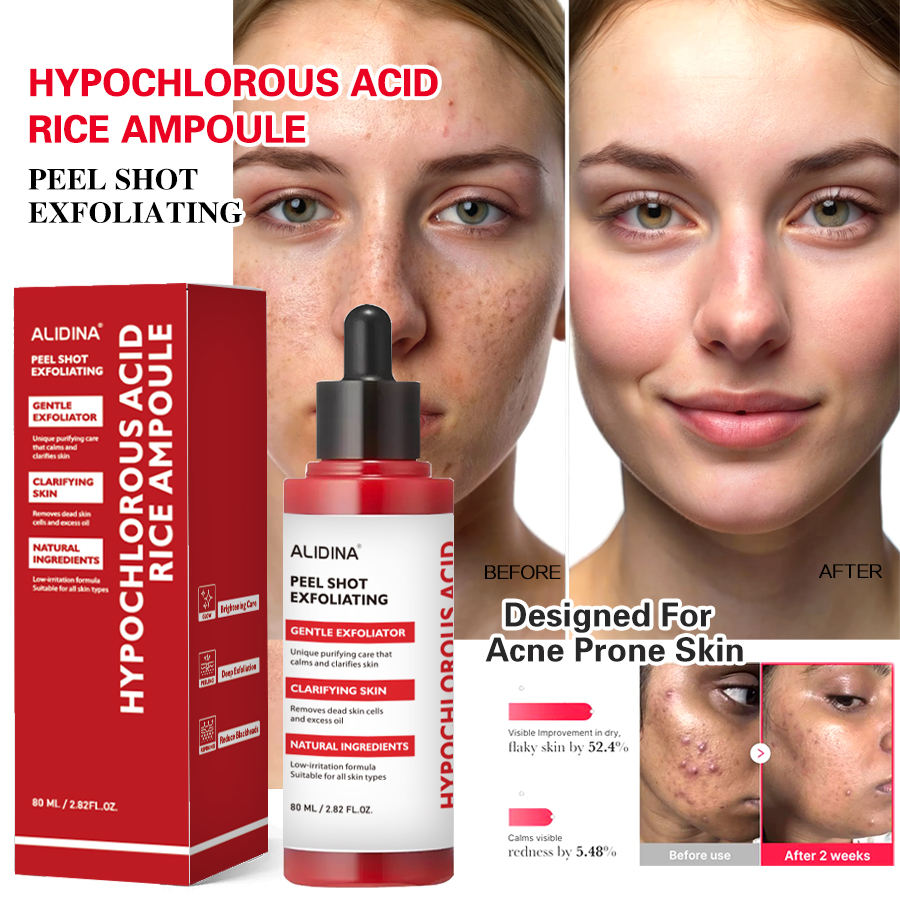 Hypochlorous Acid & Rice Peel Spray – Vitamin C Anti-Aging Exfoliating Mist