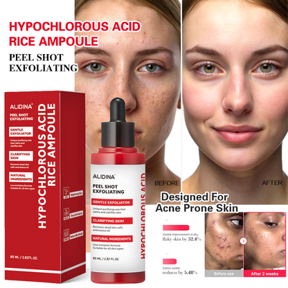 Hypochlorous Acid & Rice Peel Spray – Vitamin C Anti-Aging Exfoliating Mist