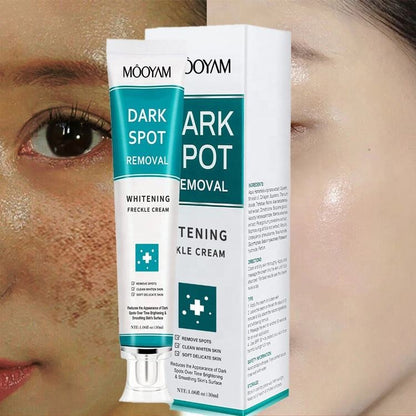 Spot Cream Melasma Remover – 30g Dark Spot & Freckle Corrector