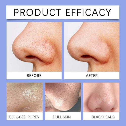 Medicube Zero Pore Blackhead Mud Mask – Deep Cleanse & Pore Care 100g