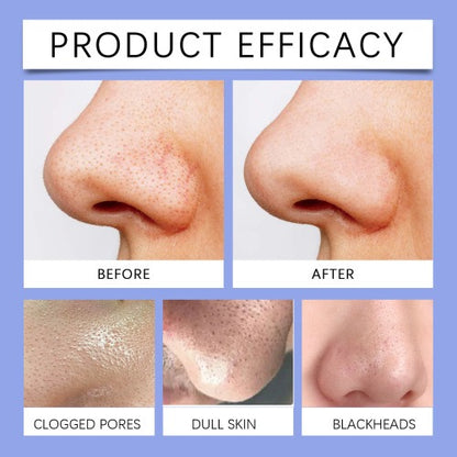 Medicube Zero Pore Blackhead Mud Mask – Deep Cleanse & Pore Care 100g