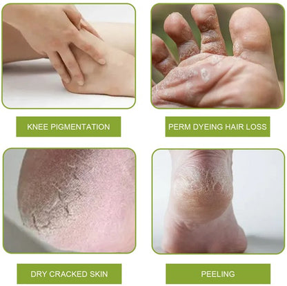 Oveallgo™ PediSoft Foot Callus Removal Spray