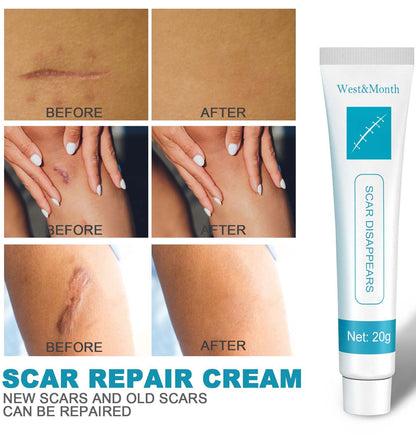 Acne Marks, Scars & Bumps Removal Creams