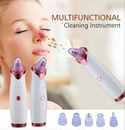Vacuum Blackhead Remover – Gentle Pore Cleansing Facial Tool