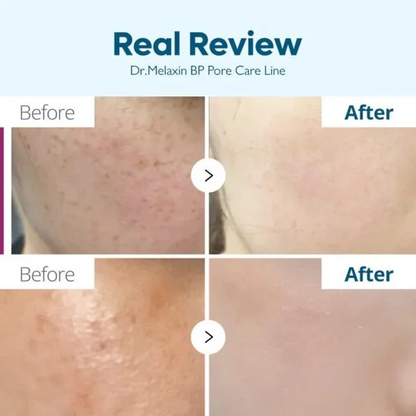 TX Skin Freckle Cream – Korean Dark Spot & Hyperpigmentation Care