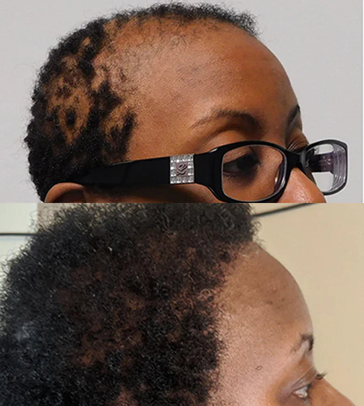 Batana Oil – Natural Hair Growth & Skin Restoration Elixir