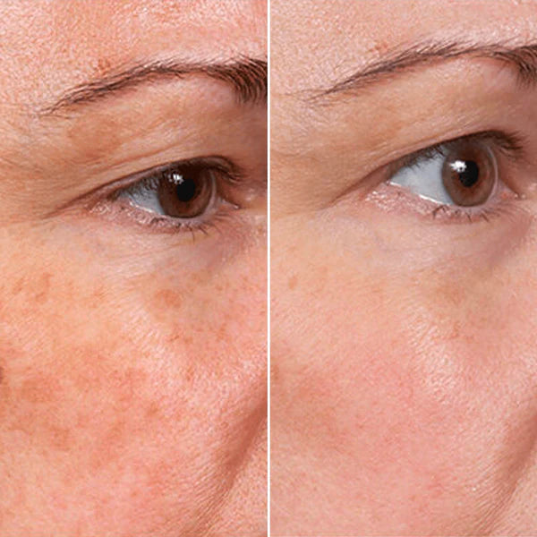 Rejuvenate Serum – Glow, Hydrate, and Defy Aging